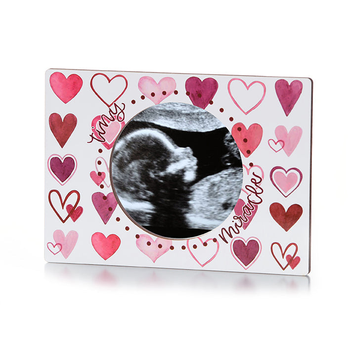 Magnetic Ultrasound Frame