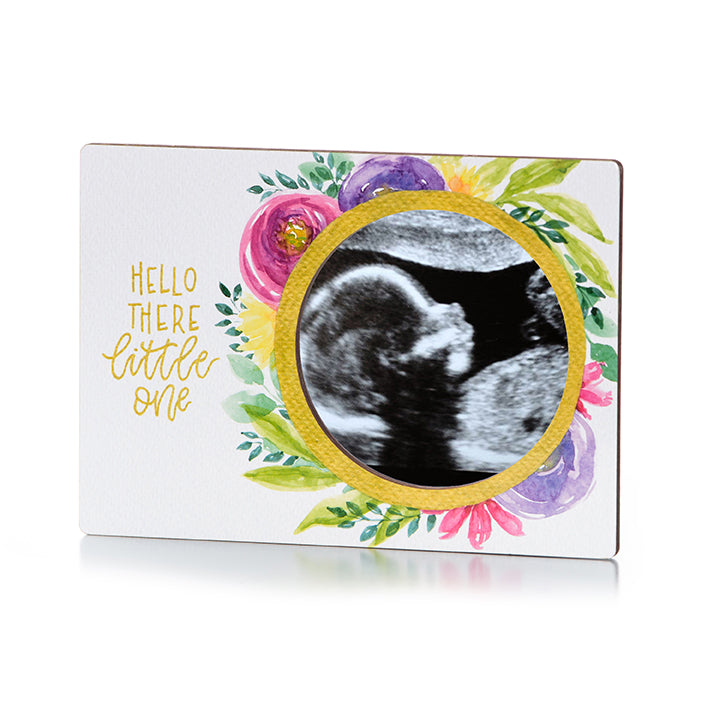 Magnetic Ultrasound Frame