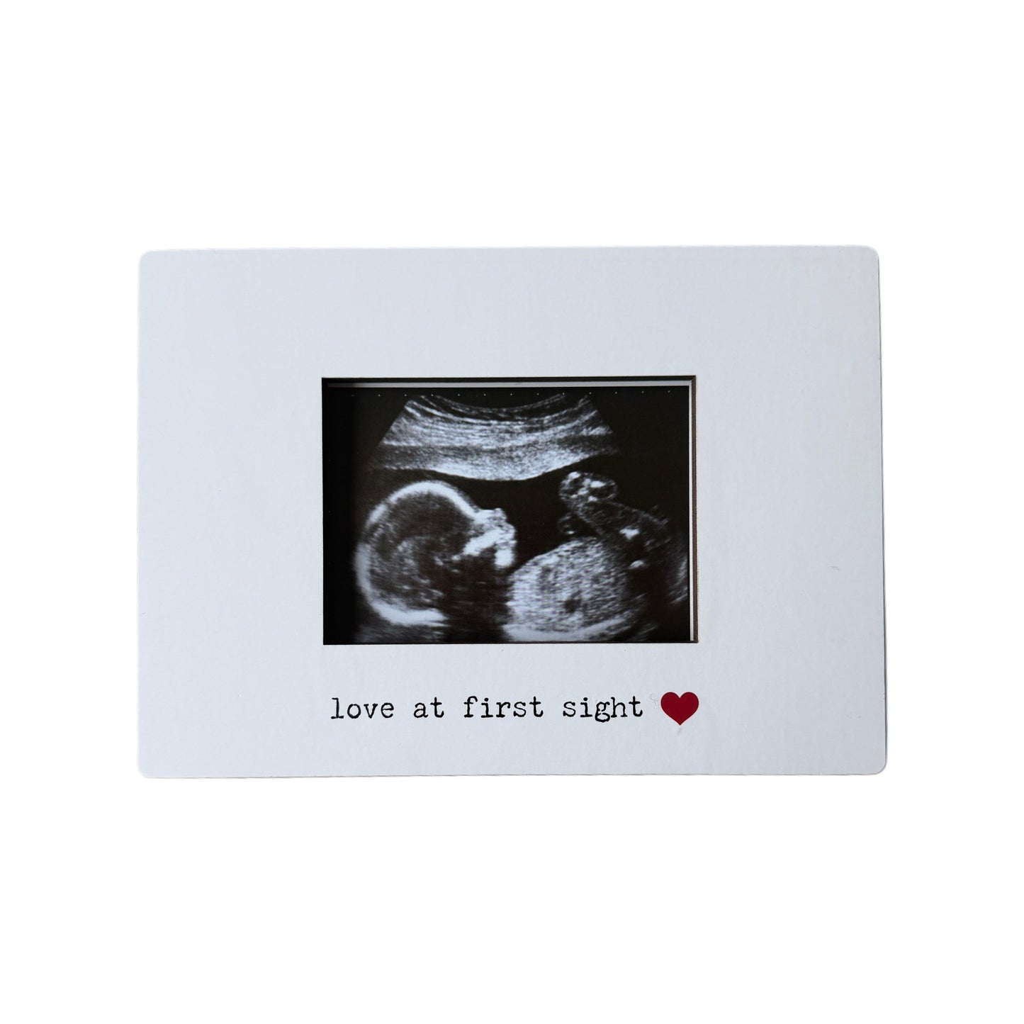 Magnetic Ultrasound Frame